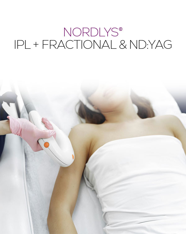 4-Nordlys